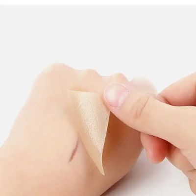 İyi fiyat Silikon yara levhaları, bant, şeritler - İyileşen Keloid, Sezaryen, Karın ameliyatı - Cerrahi Yara Tedavisi çevrimiçi