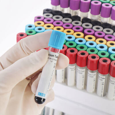 İyi fiyat Tam Kan Sayımı (CBC) için Vakumlu EDTA'lı Kan Tüpleri – Yüksek Kalite, Güvenli Mühür çevrimiçi